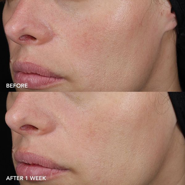 Image Skincare MD Barrier Repair Recovery Balm MD-129 фото