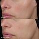 Image Skincare MD Barrier Repair Recovery Balm MD-129 фото 3